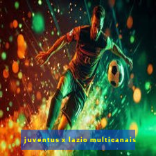 juventus x lazio multicanais